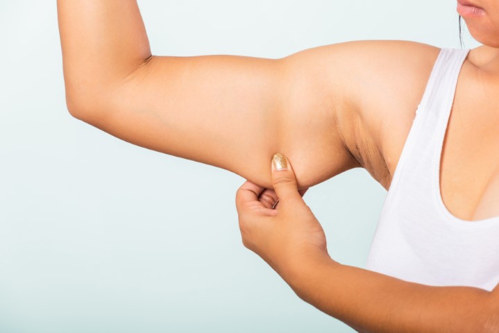 Stubborn Fat Treatment