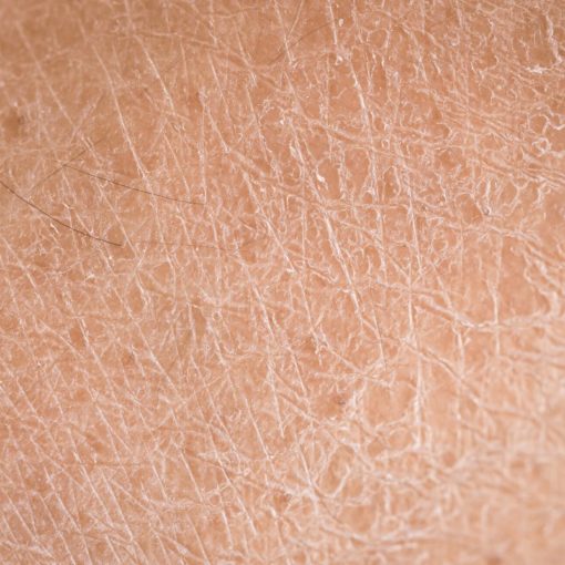 Skin Congestion Treatments